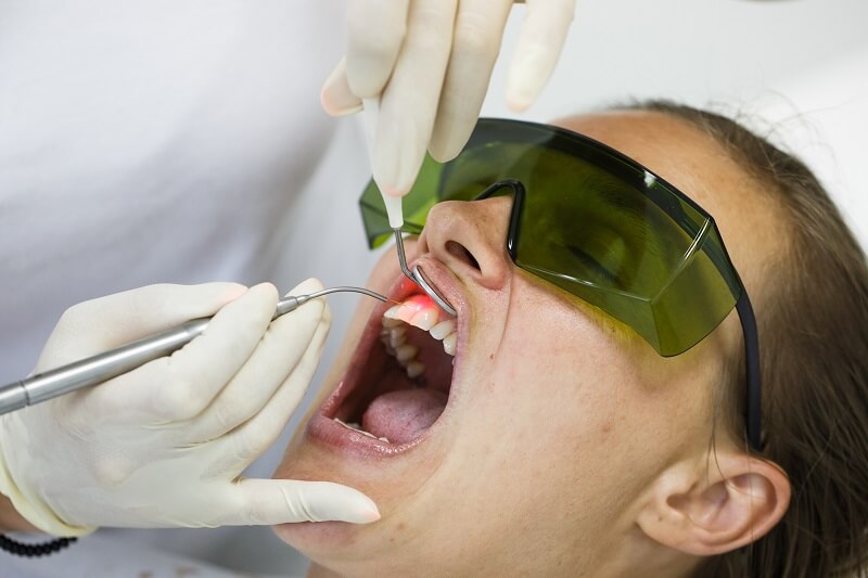 lady having laser dentistry work done