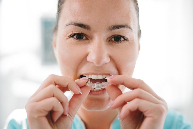 Close up of dentist putting transparent teeth aligner in teeth