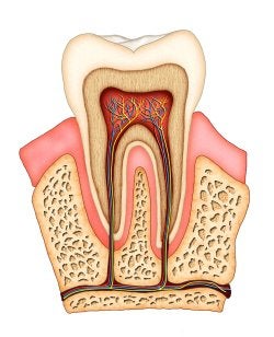 Root Canals Explained